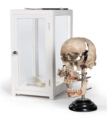 A 19th century exploded Human Skull - Historische wissenschaftliche Instrumente und Globen - Klassische Fotoapparate und Zubehör
