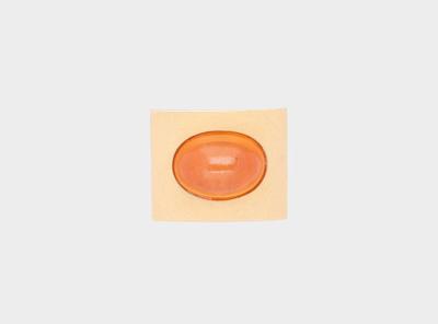 Mandaringranat Ring ca. 15 ct - Exquisite gemstones